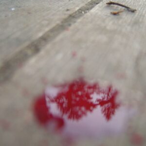 Hypothermia – Veins